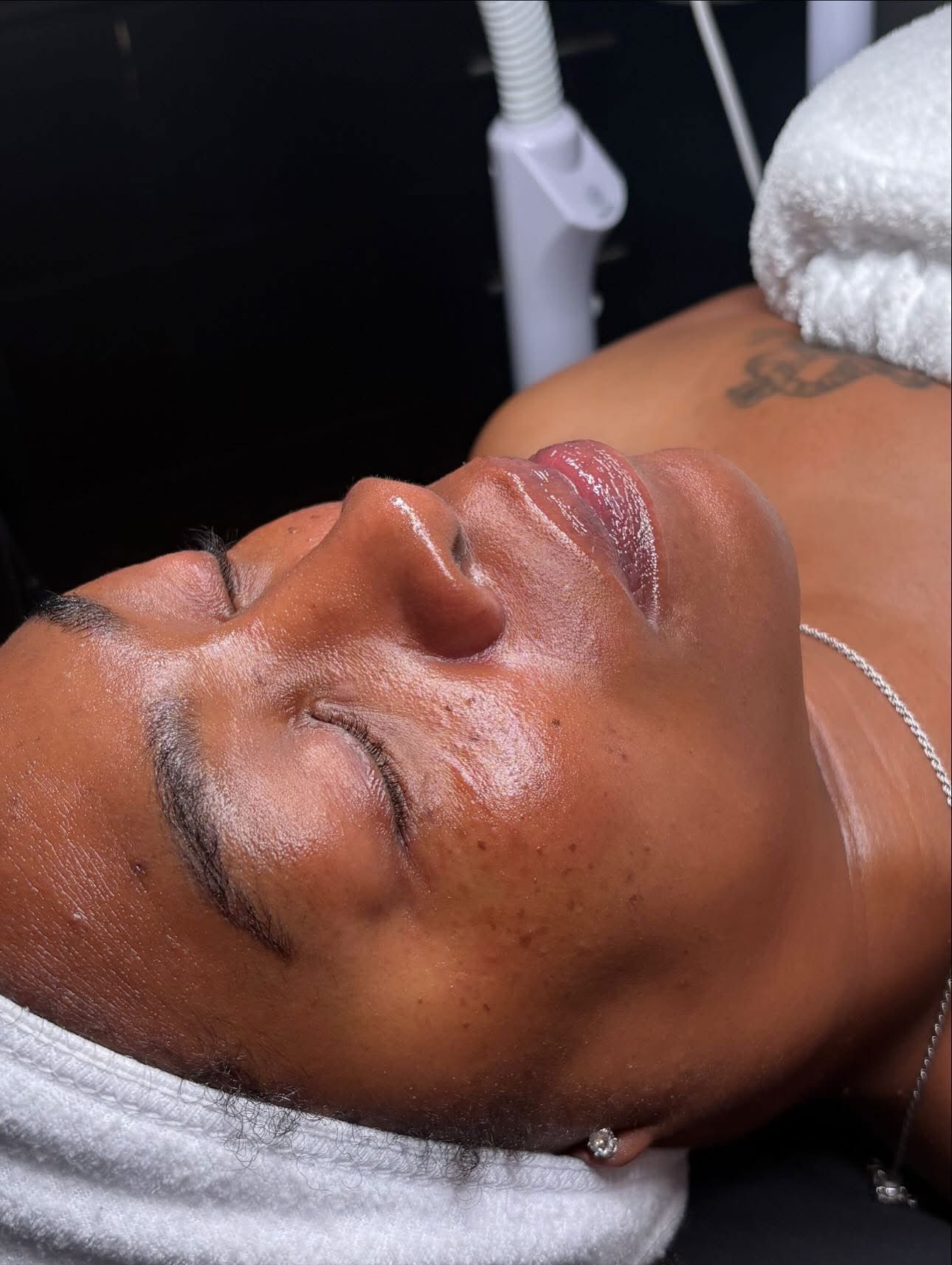 Skincare treatment Overland Park